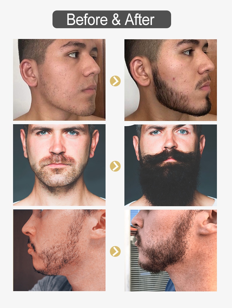 Anti Hair Loss Beard Oil for Men